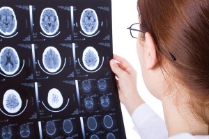 Traumatic Brain Injury